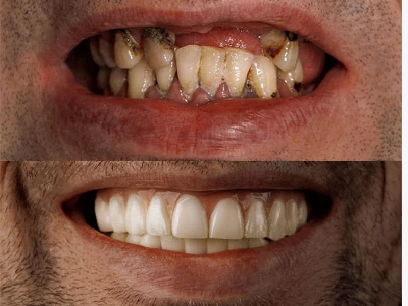 Periodontology & Periodontol Diseases Image