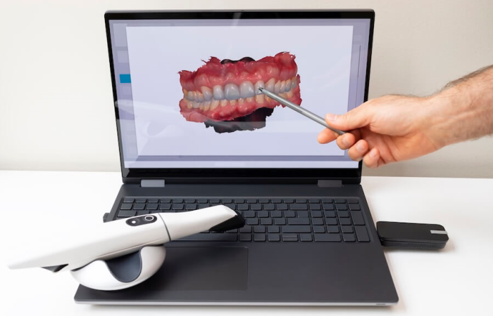 digital smile desing turkey